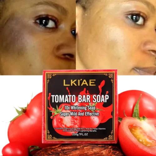 High Quality Handmade TOMATO Bar Soap Super Mild White + Vitamin A&C 200g - Image 5