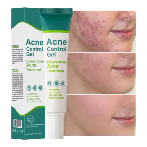 Salicylic Acid Gel Lighten Acne Ceramide Lactate Acne Cream 30g - Image 4